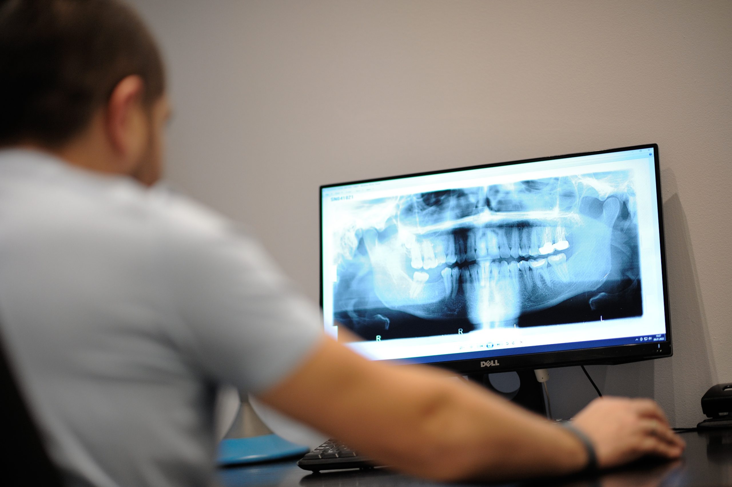 Radiologia dentara